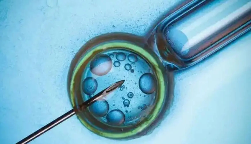 研究称人造子宫人体试验或将启动